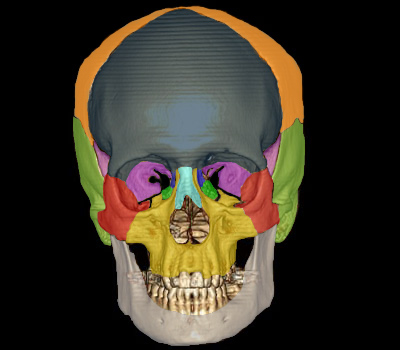 os du crâne (face)