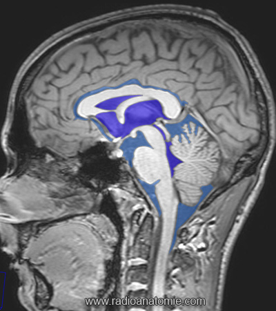 La coupe sagittale médiane en IRM