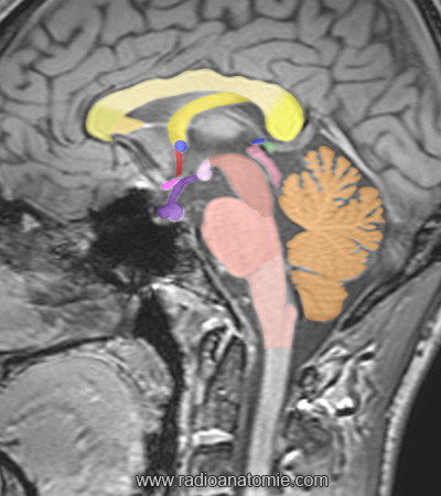 Mid sagittal plane